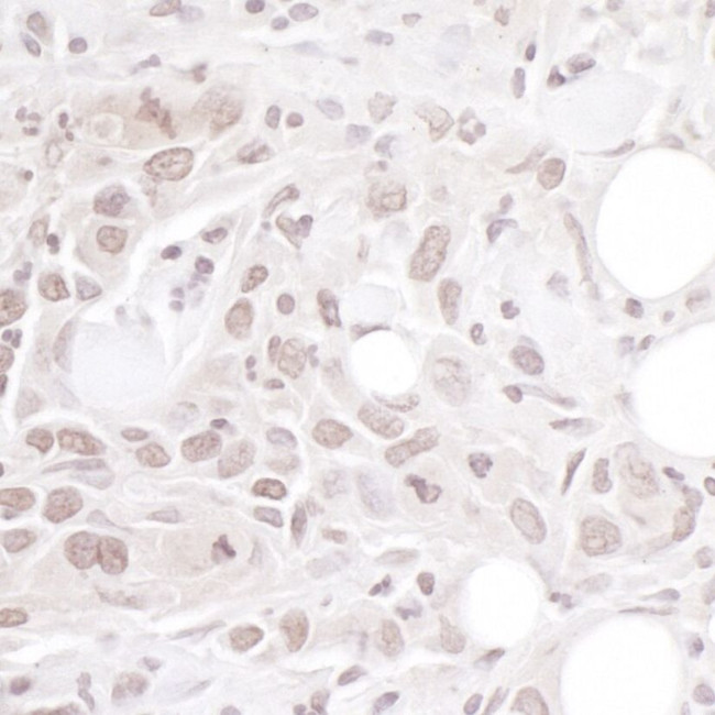 Geminin Antibody in Immunohistochemistry (IHC)