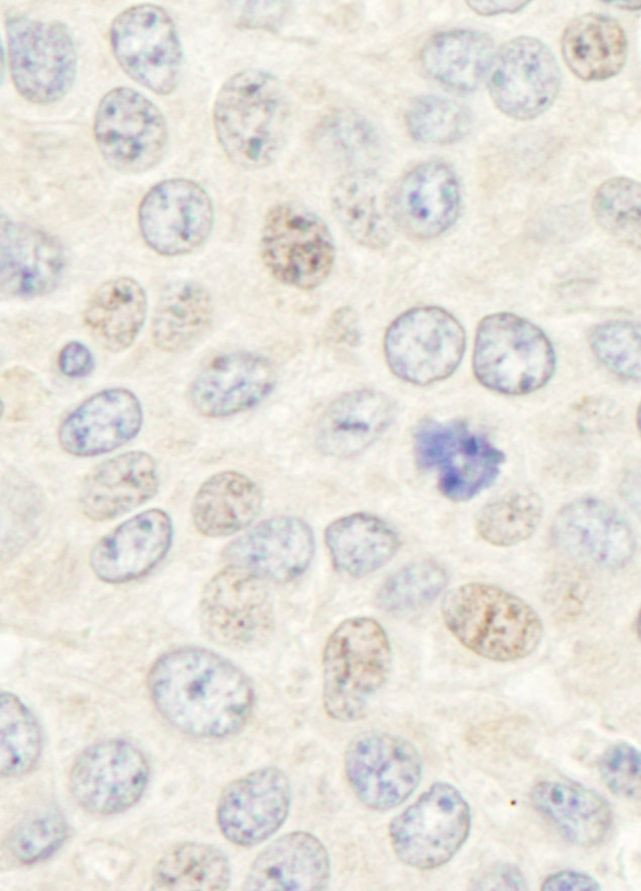 Geminin Antibody in Immunohistochemistry (IHC)