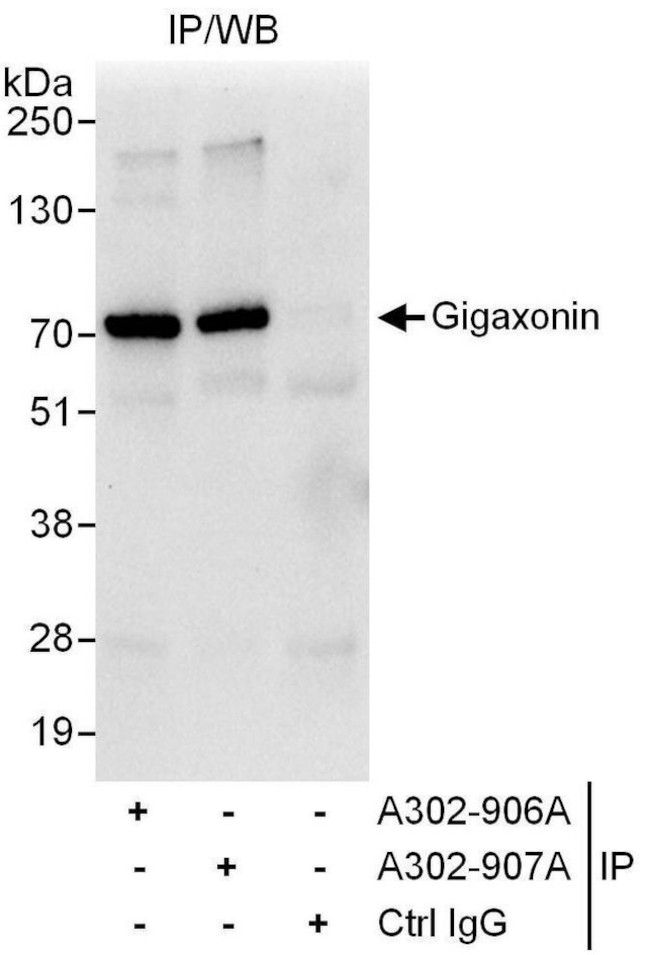 Gigaxonin Antibody in Immunoprecipitation (IP)