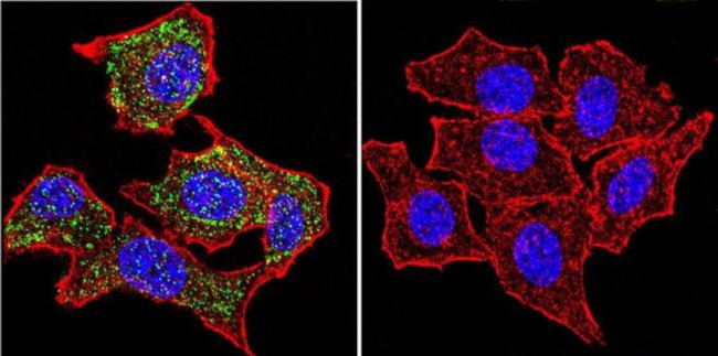 Glucocorticoid Receptor alpha Antibody in Immunocytochemistry (ICC/IF)