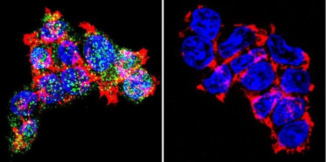 Glucocorticoid Receptor Antibody in Immunocytochemistry (ICC/IF)