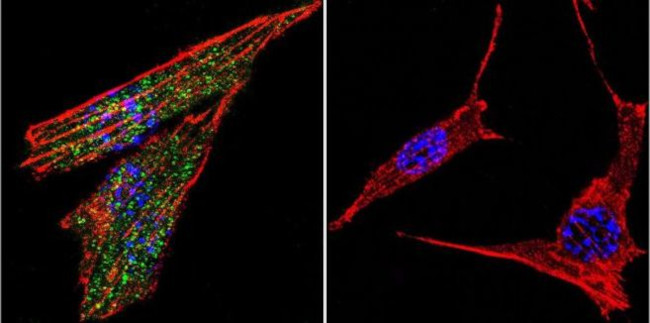 Glucocorticoid Receptor Antibody in Immunocytochemistry (ICC/IF)