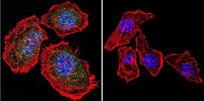 Glucocorticoid Receptor Antibody in Immunocytochemistry (ICC/IF)