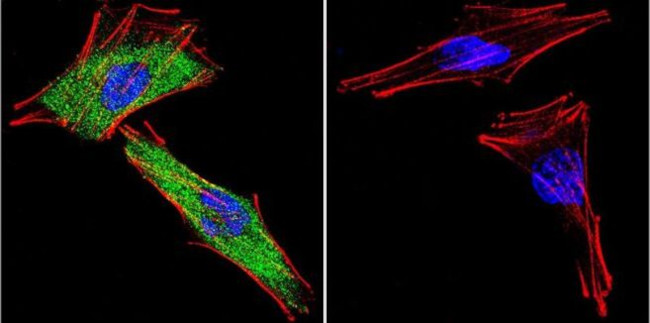 Glucocorticoid Receptor Antibody in Immunocytochemistry (ICC/IF)