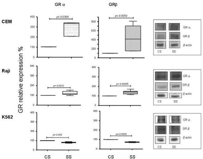 Glucocorticoid Receptor beta Antibody in Western Blot (WB)