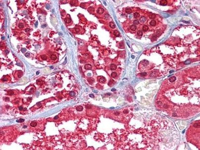 GPI Antibody in Immunohistochemistry (Paraffin) (IHC (P))