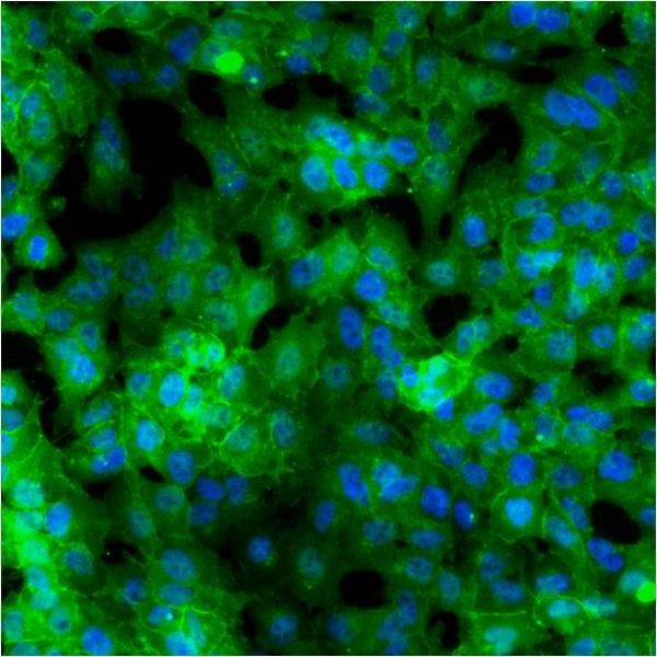 GLUT1 Antibody in Immunocytochemistry (ICC/IF)