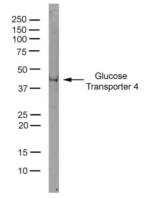 GLUT4 Antibody in Western Blot (WB)