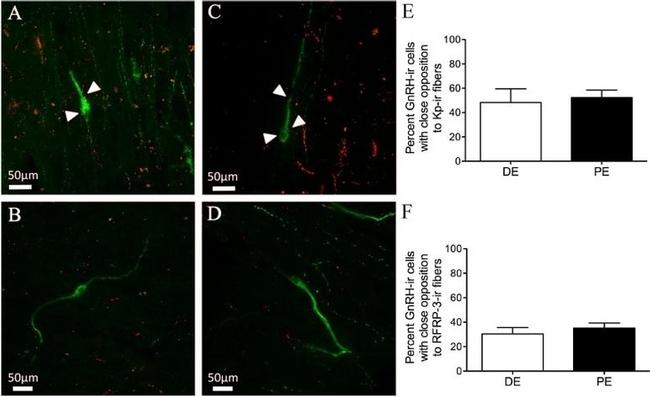 GnRH1 Antibody in Immunohistochemistry - Free Floating (IHC (Free))