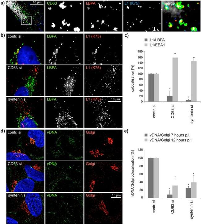 Golgin-97 Antibody in Immunocytochemistry (ICC/IF)