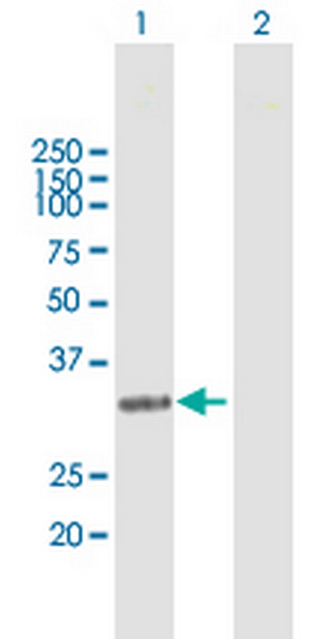 NAT1 Antibody in Western Blot (WB)