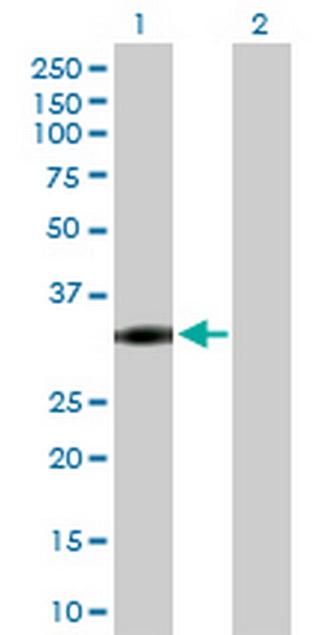 NAT1 Antibody in Western Blot (WB)