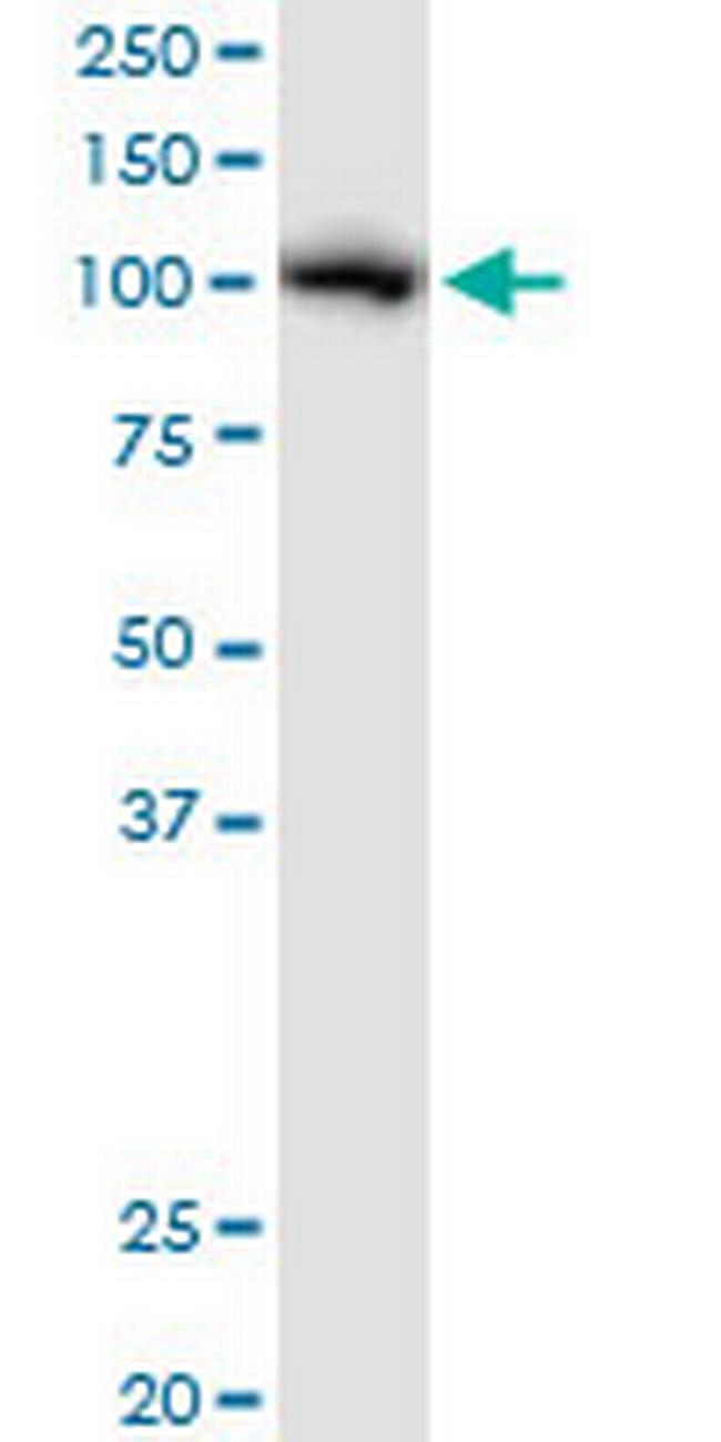 AARS Antibody in Western Blot (WB)