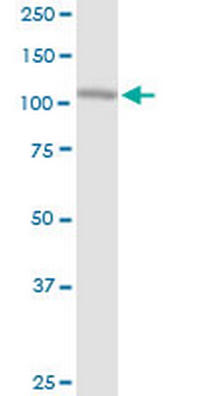 ABCF1 Antibody in Western Blot (WB)