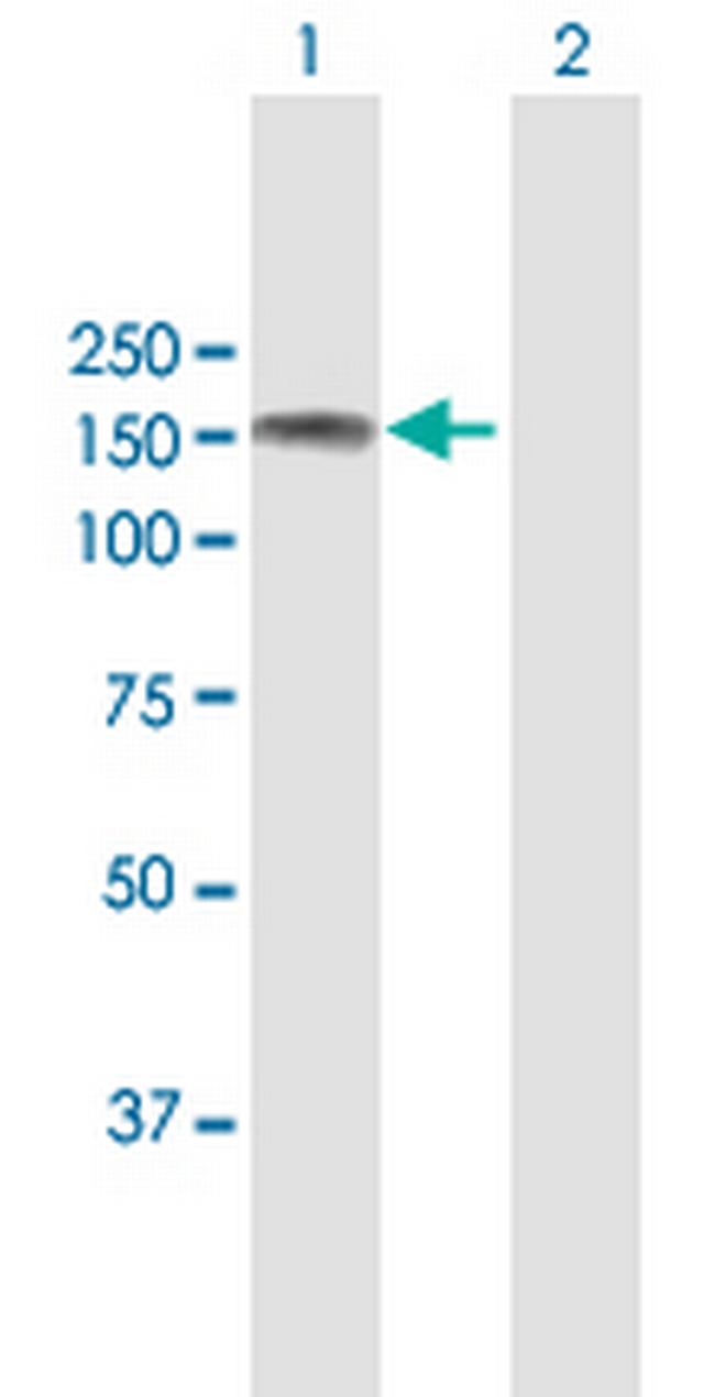 ABL2 Antibody in Western Blot (WB)