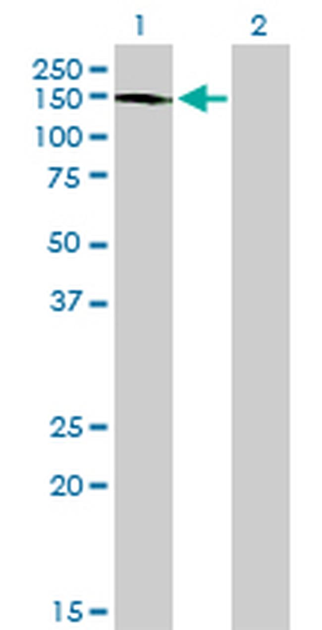 ABL2 Antibody in Western Blot (WB)