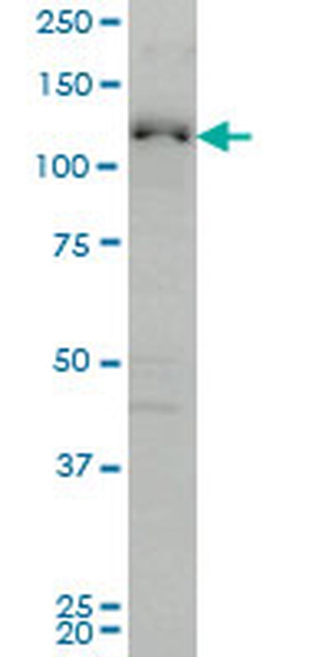 ABL2 Antibody in Western Blot (WB)