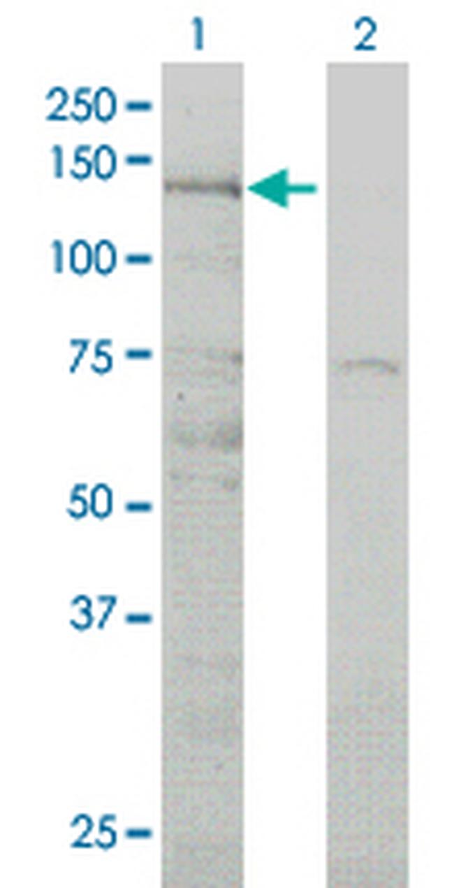 ABL2 Antibody in Western Blot (WB)