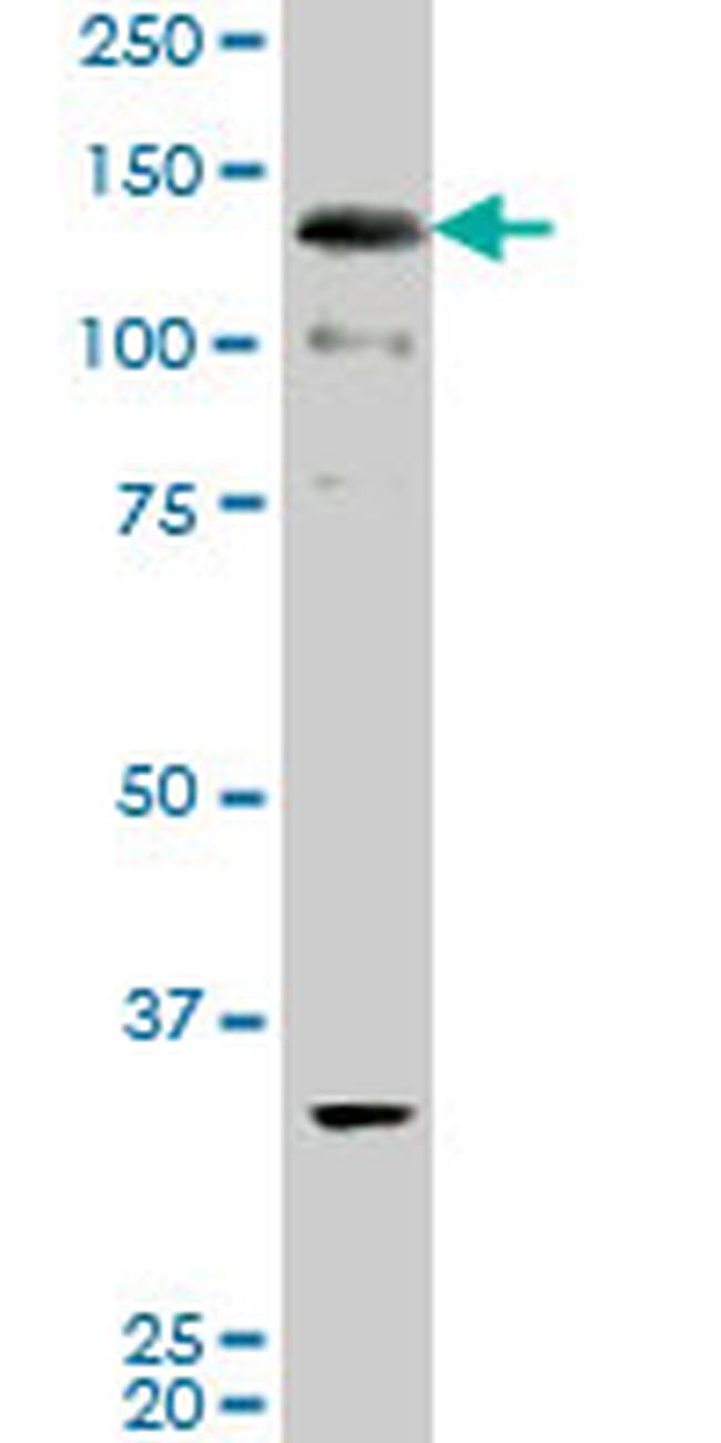 ABL2 Antibody in Western Blot (WB)