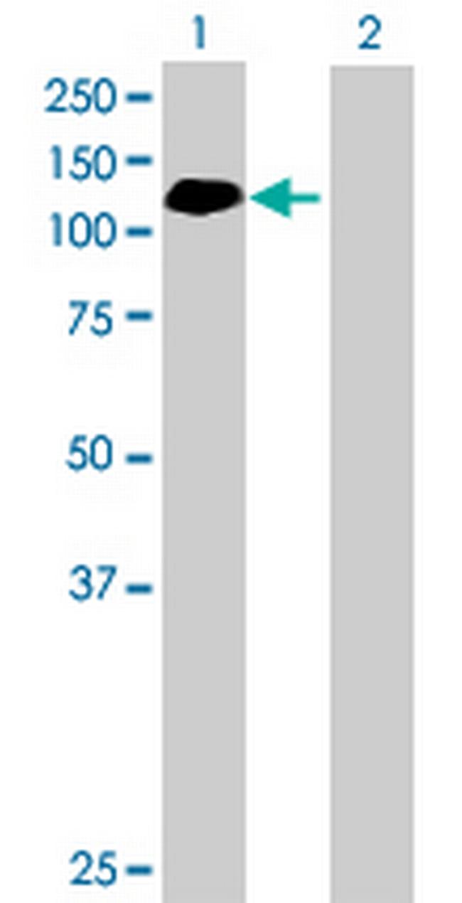 ABR Antibody in Western Blot (WB)