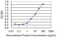 ACAA1 Antibody in ELISA (ELISA)