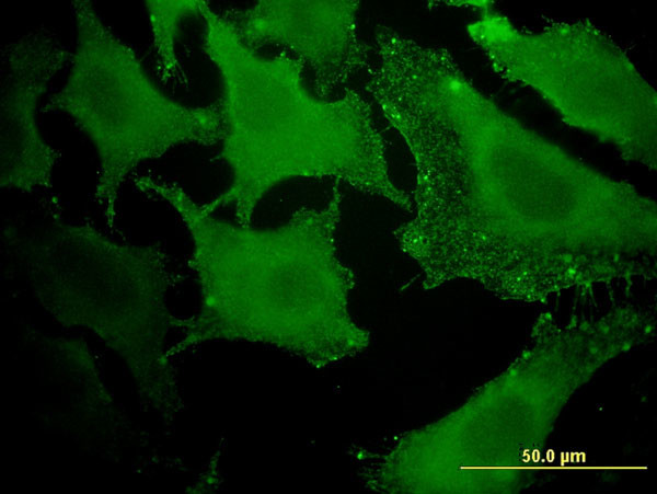 ACAA1 Antibody in Immunocytochemistry (ICC/IF)