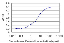 ACADVL Antibody in ELISA (ELISA)