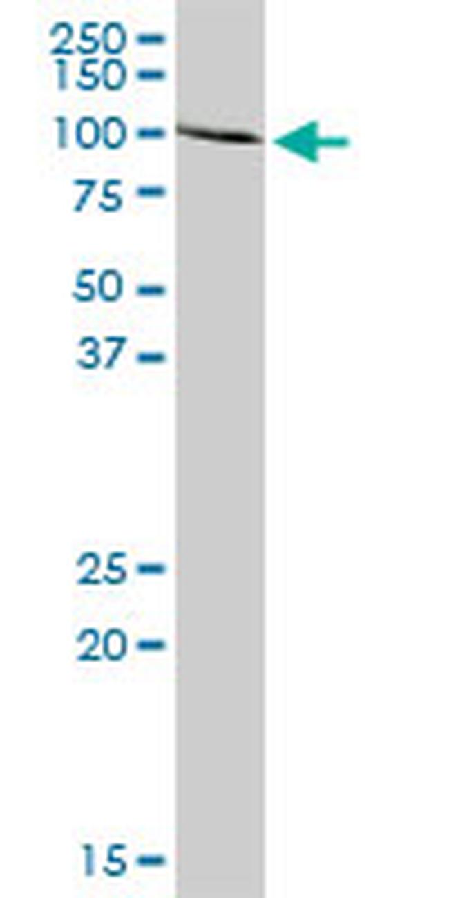 ACO1 Antibody in Western Blot (WB)