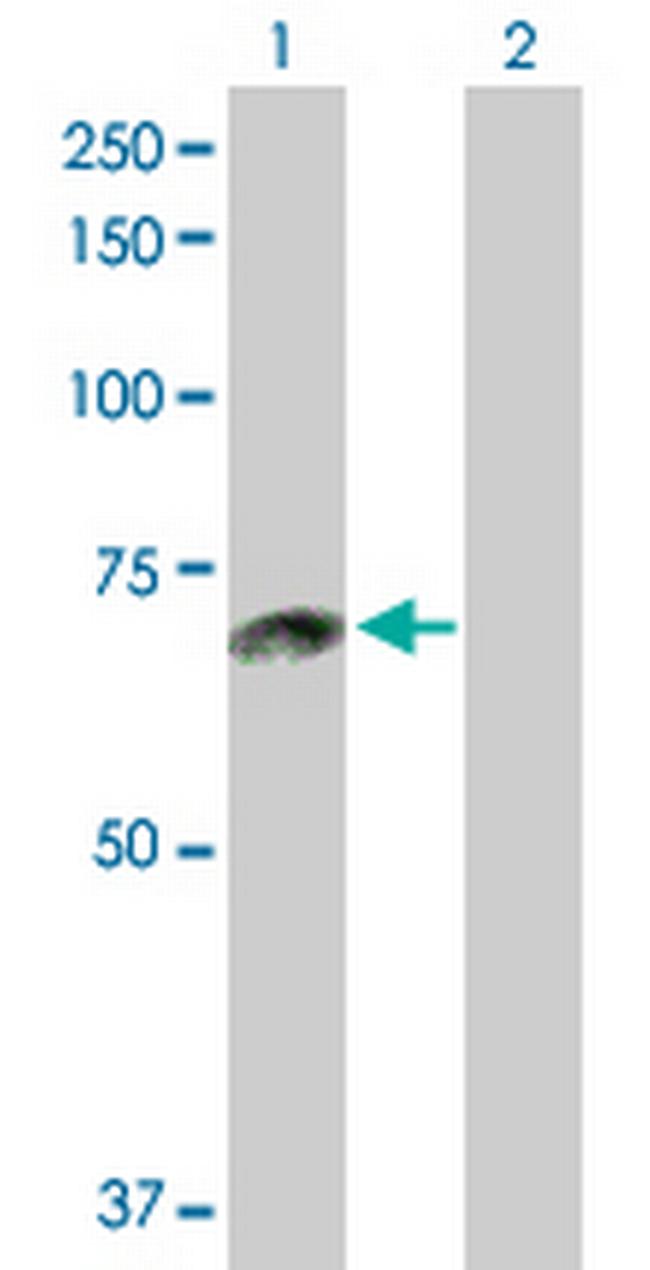 ACOX1 Antibody in Western Blot (WB)