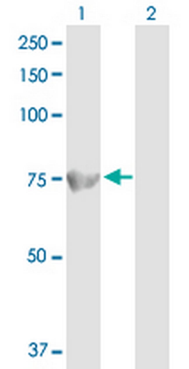 ACOX1 Antibody in Western Blot (WB)