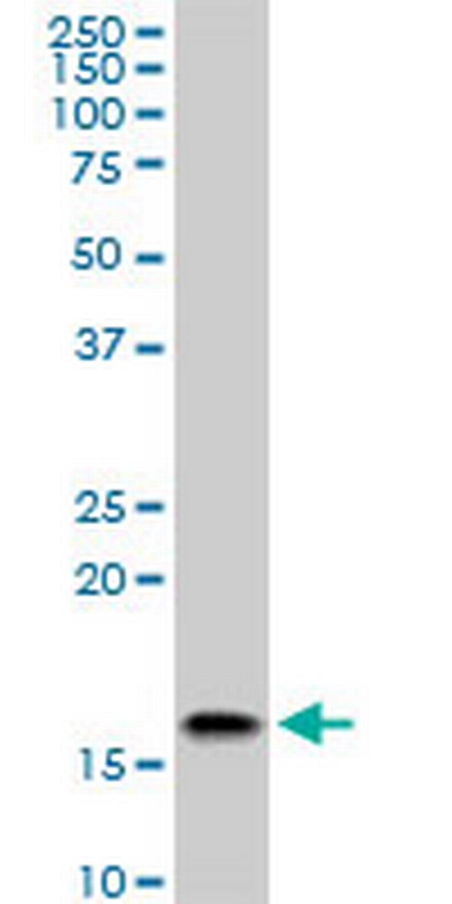 ACP1 Antibody in Western Blot (WB)