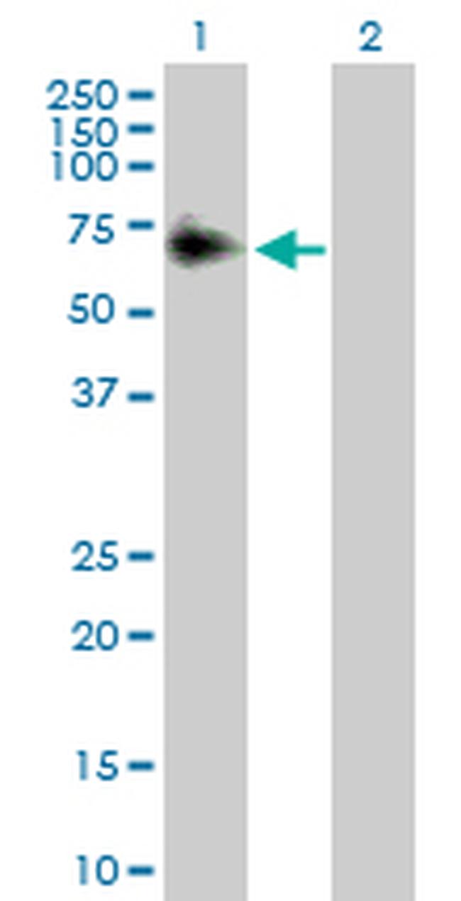 ACP2 Antibody in Western Blot (WB)