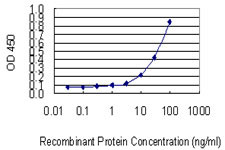 ACP2 Antibody in ELISA (ELISA)