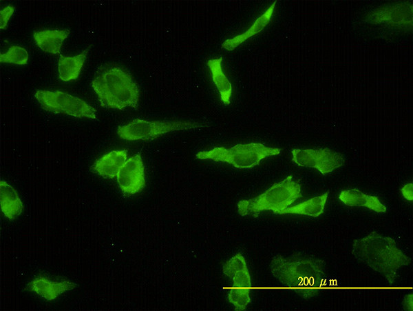 ACP2 Antibody in Immunocytochemistry (ICC/IF)