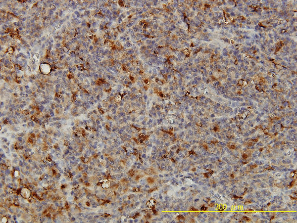 ACP2 Antibody in Immunohistochemistry (Paraffin) (IHC (P))