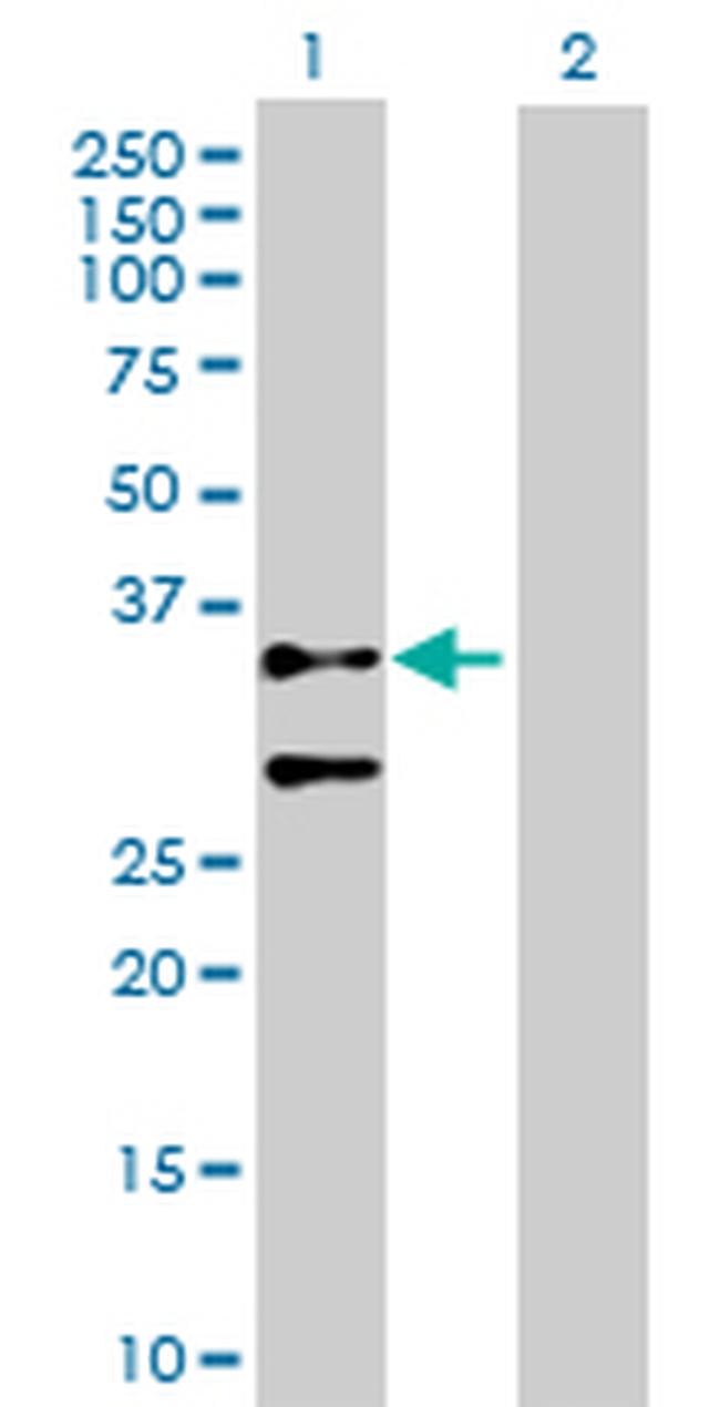 ACTG2 Antibody in Western Blot (WB)