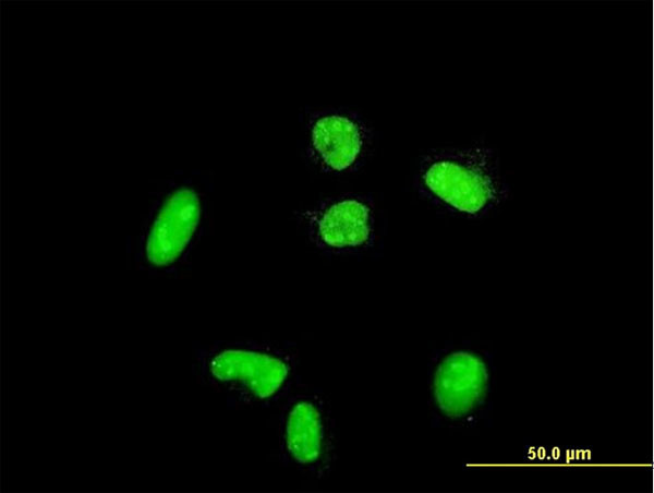 ACTN4 Antibody in Immunocytochemistry (ICC/IF)