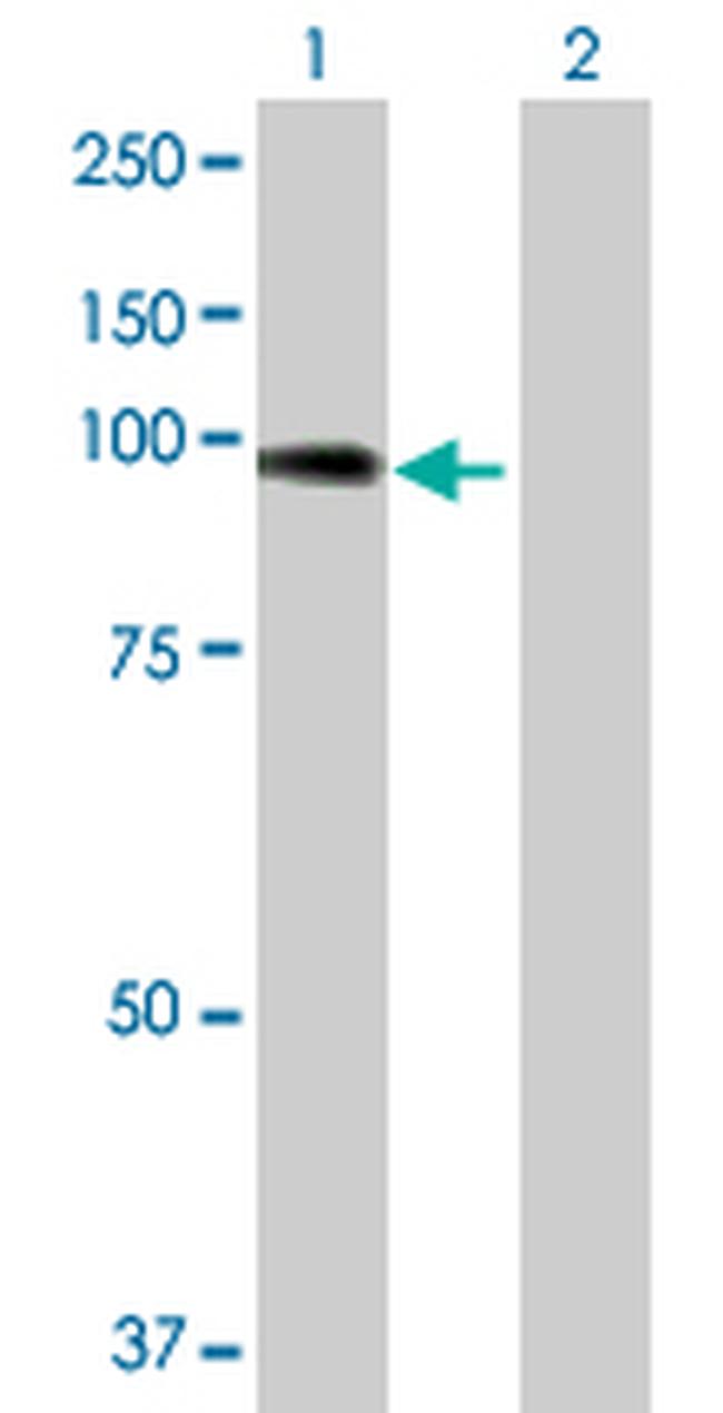 ACTN4 Antibody in Western Blot (WB)