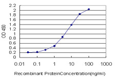 ACTN4 Antibody in ELISA (ELISA)