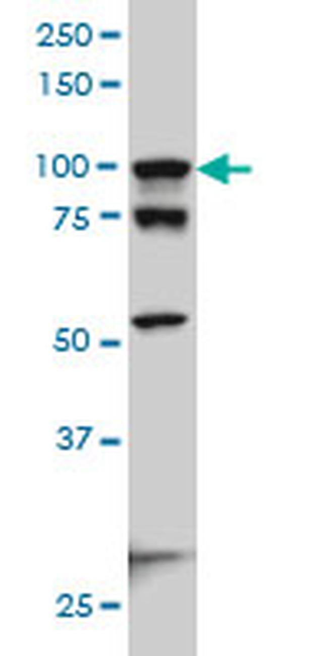 ACTN4 Antibody in Western Blot (WB)