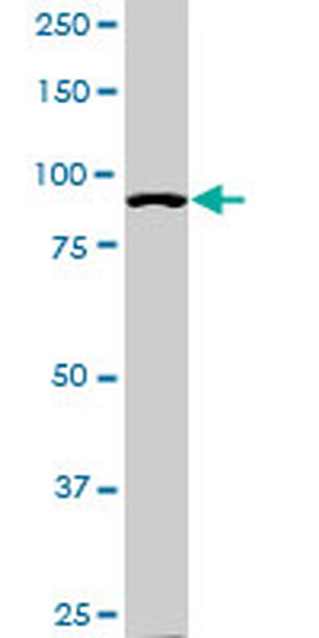 ACTN4 Antibody in Western Blot (WB)