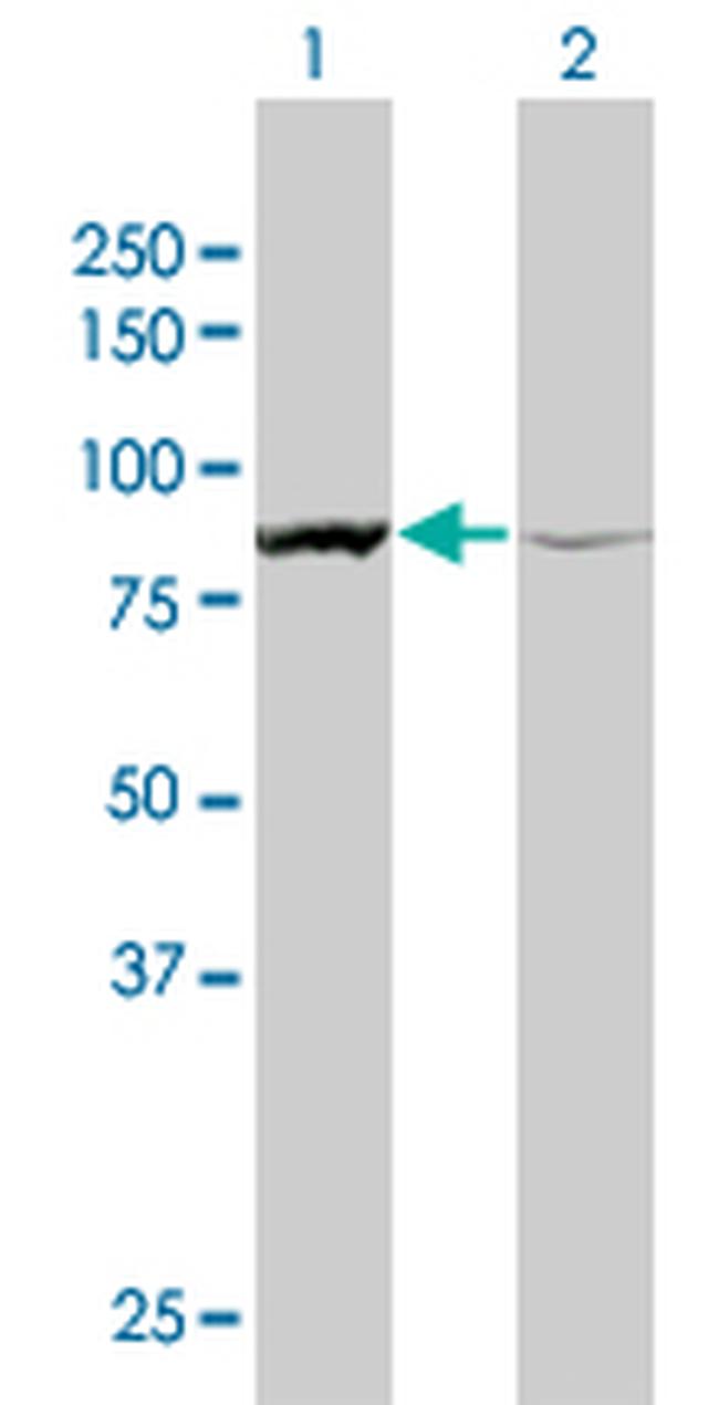 ACTN1 Antibody in Western Blot (WB)