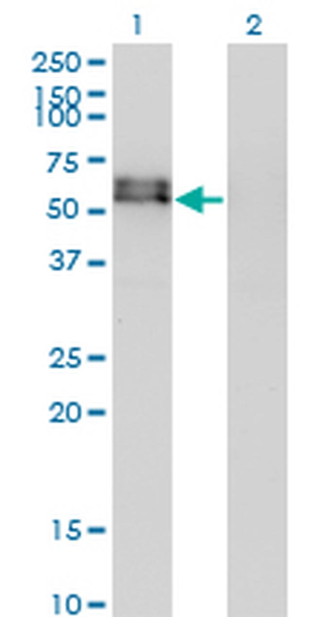 ACVR1 Antibody in Western Blot (WB)