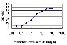 ACVR1B Antibody in ELISA (ELISA)