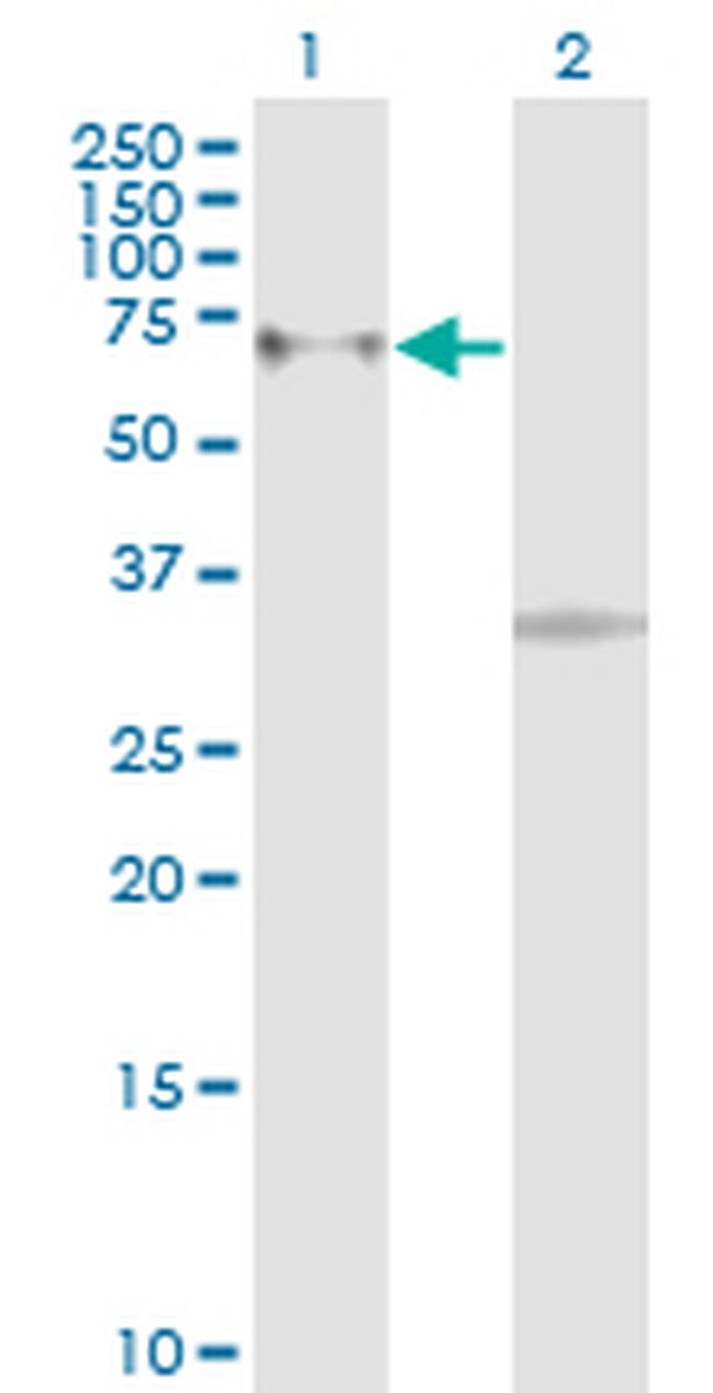 ACVR1B Antibody in Western Blot (WB)