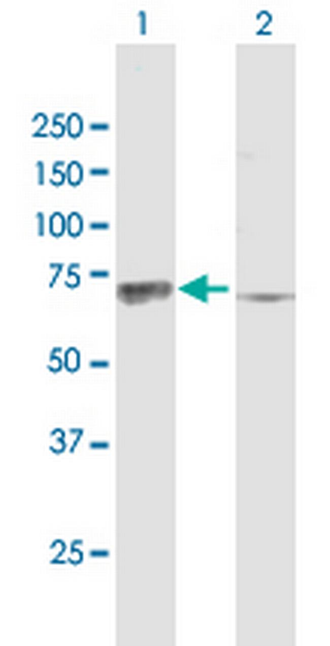 ACVR2A Antibody in Western Blot (WB)