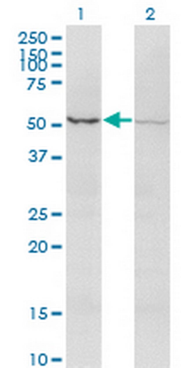 ACVR2B Antibody in Western Blot (WB)