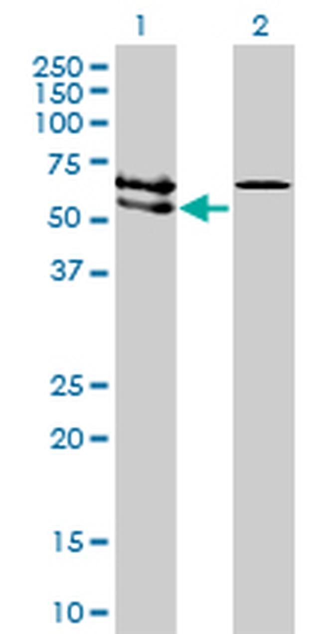 ACVRL1 Antibody in Western Blot (WB)