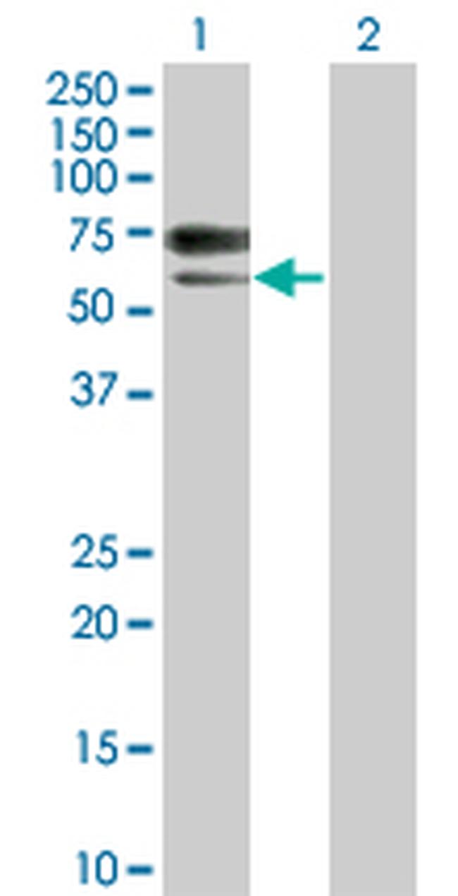 ACVRL1 Antibody in Western Blot (WB)