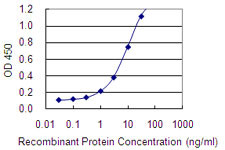 ACVRL1 Antibody in ELISA (ELISA)